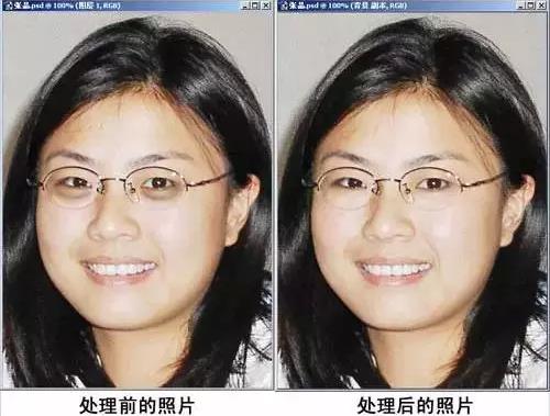 PS快速消除黑眼圈缩略图